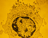 False-col TEM of HIV-2 (AIDS) virus particles