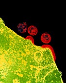 False-col TEM of AIDS virus replication in T-cell
