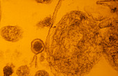 Tinted TEM of AIDS virus budding from T-cell