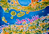 False-colour TEM of rubella virus particles