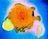 TEM of measles virion with ruptured envelope