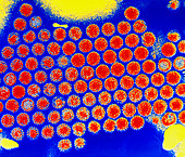 Coloured TEM of rotavirus virions
