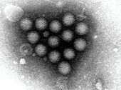 TEM of rotavirus
