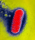 Coloured TEM of an orf virus