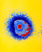 Coloured TEM of a Herpes simplex virus