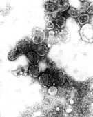 TEM of the HIV virus: cause of AIDS