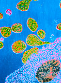 TEM of Rubella viruses