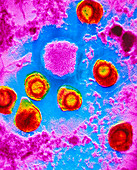 False-colour TEM of Cytomegalovirus particles
