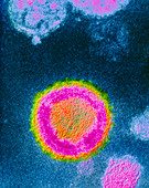 False-colour TEM of HIV-2 virus causing AIDS