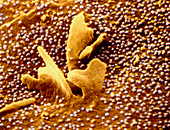 F/col SEM of rubella erupting from a cell surface