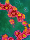 Coloured TEM of rubella virus particles