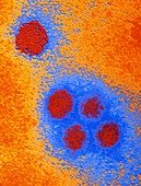 Coloured TEM of Dengue virus particles
