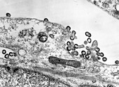 TEM of Maedi-Visna viruses budding from cell