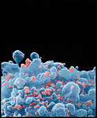 Coloured SEM of a T-cell infected with AIDS virus