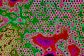 Coloured TEM of clusters of polio viruses (type 1)
