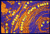 Coloured TEM of herpes simplex viruses in nucleus