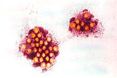 Coloured TEM of Norwalk viruses