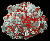 SEM of T-cell infected with AIDS viruses