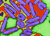 Coloured TEM of nuclear polyhedrosis viruses