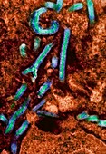 Ebola virus,TEM