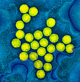 Polio viruses,TEM