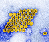 Polio virus,TEM