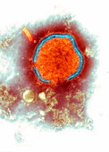 Measles virus,TEM