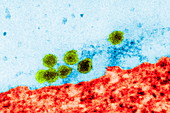 West Nile virus,TEM