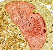 Epstein-Barr virus infection,TEM