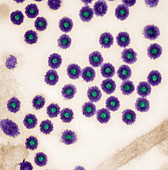 Vesicular stomatitis virus,TEM