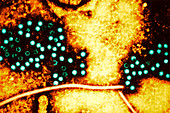 Hepatitis E virus particles,TEM
