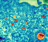 HIV particles in infected cell,TEM