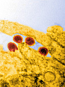 Chikungunya virus particles