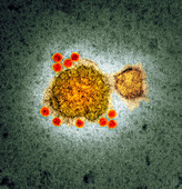 Parvovirus particles,TEM