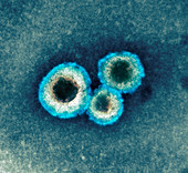 Human metapneumovirus particles,TEM