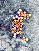 Human bocavirus,TEM