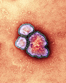 Measles virus particles,TEM