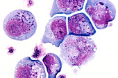 Leucocytes infected with herpes virus,LM