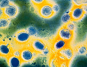 False-colour TEM of influenza virus particles