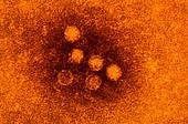 Tinted TEM of rhinovirus,cause of common cold