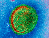 False-col TEM of a single influenza virus