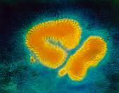 TEM of Hong Kong flu virus