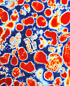 Coloured TEM of Asian flu viruses