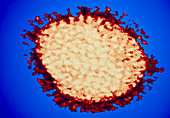 Coloured TEM of influenza virus