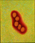 Colour TEM of a cluster of five influenza viruses