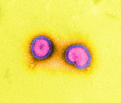 Influenza virus,TEM