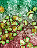 H5N1 avian influenza virus particles,TEM