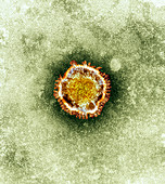 SARS virus,TEM