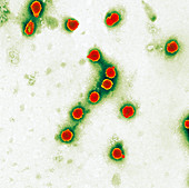 Avian influenza virus particles,TEM