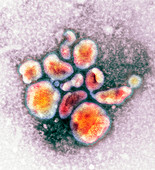 Avian influenza virus particles,TEM